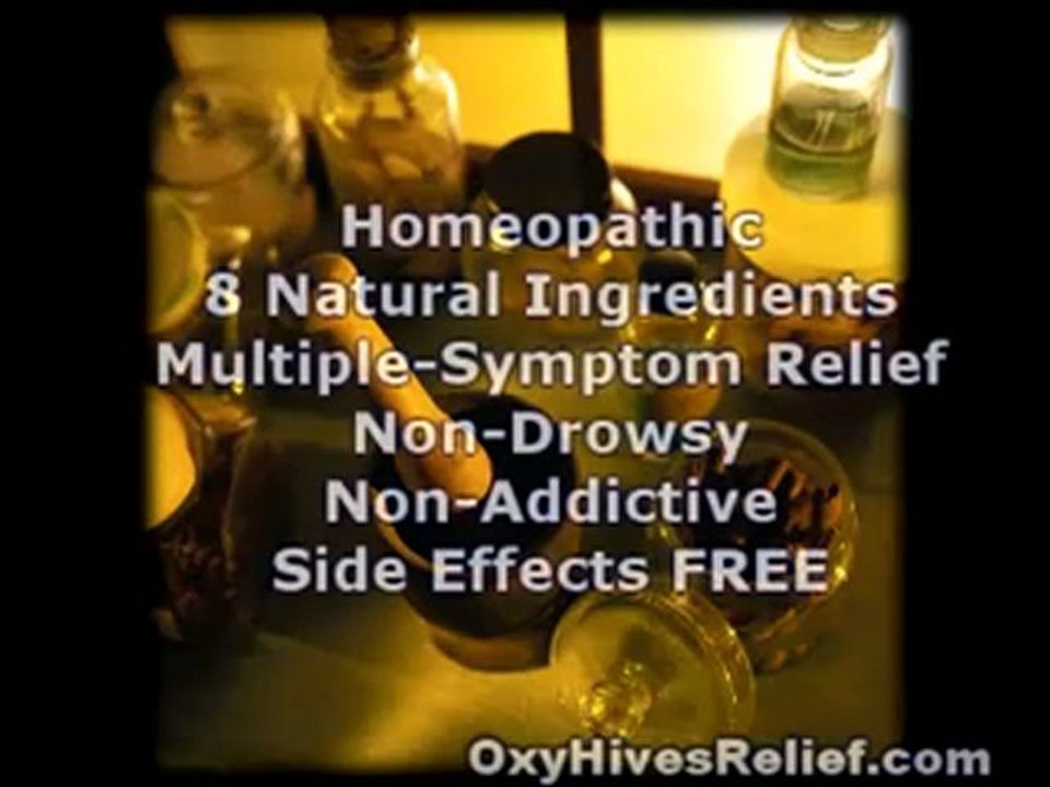 OxyHives Relief - Review Natural Remedies For Hives_