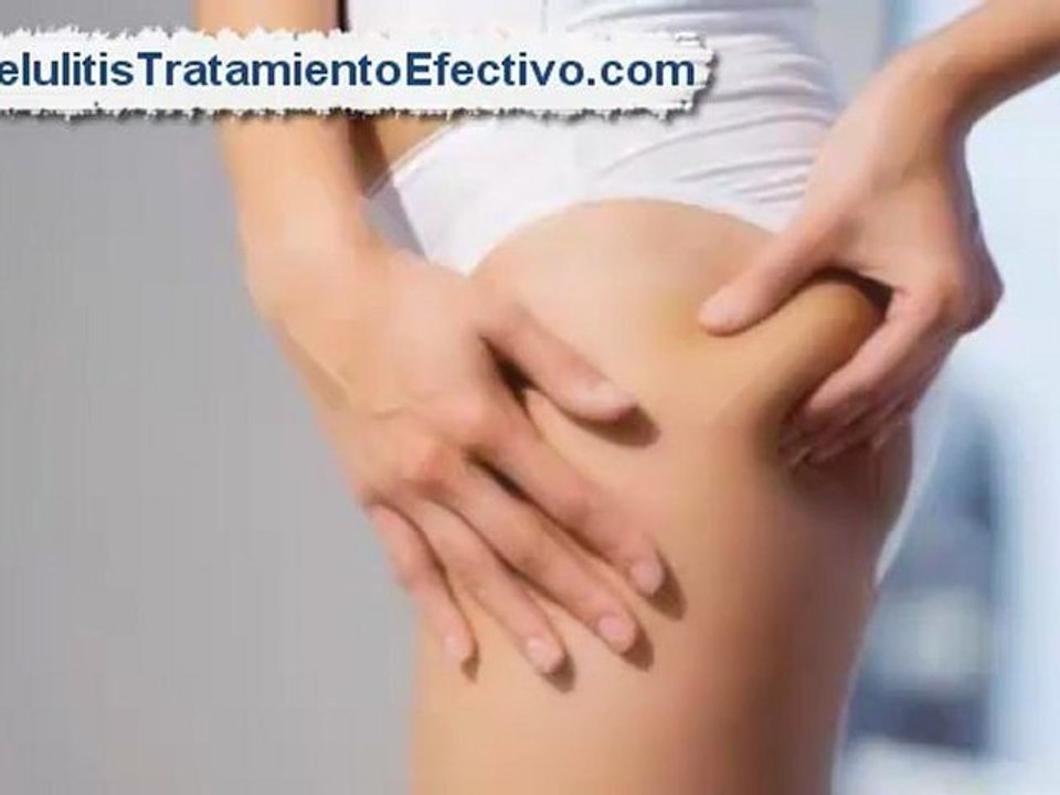 Como Eliminar Celulitis Rapido - [Combatir la celulitis]