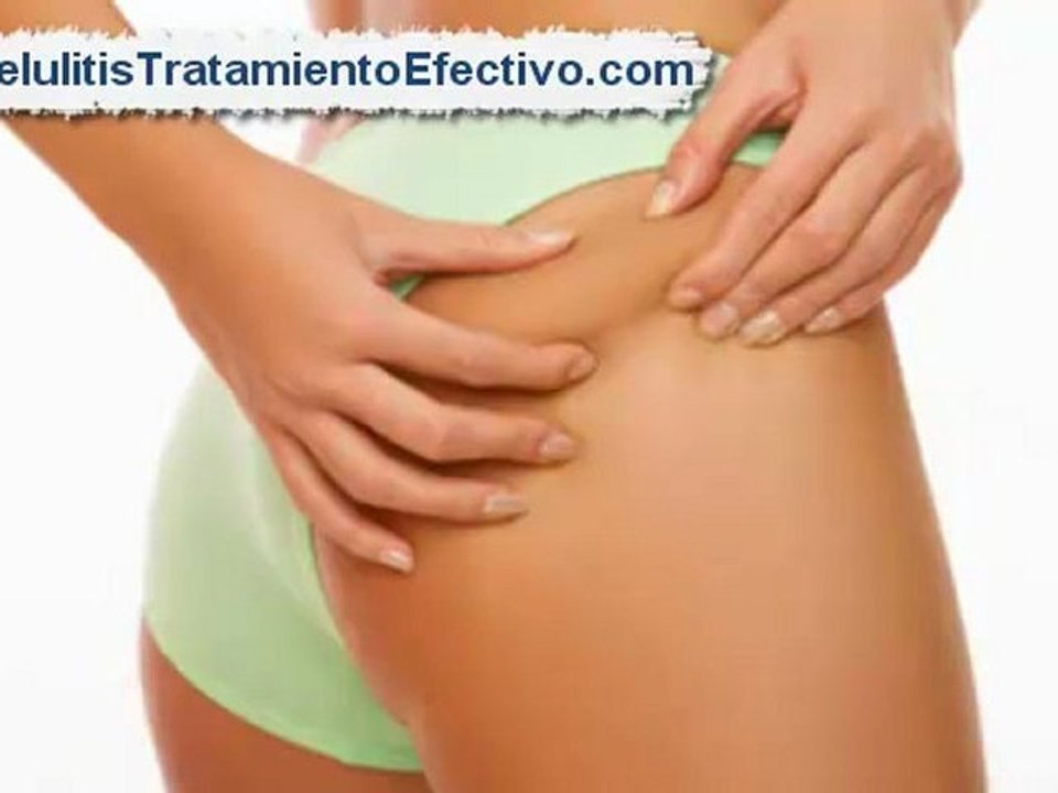 Como Eliminar la Celulitis [Reducir celulitis]