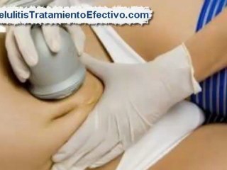 Como Quitar la Celulitis Rapido [Como combatir la celulitis en las piernas]