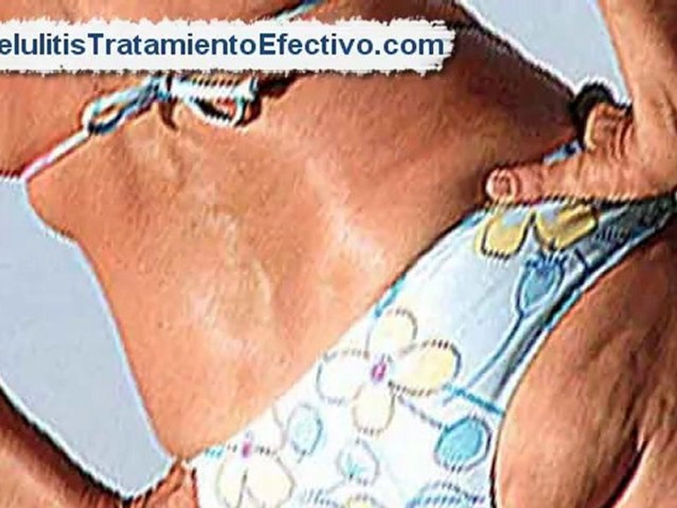 Como Eliminar Celulitis [Celulitis tratamiento natural]