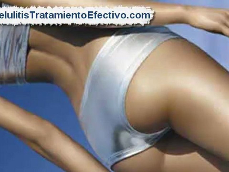 Como Quitar Celulitis [Como elimino la celulitis]