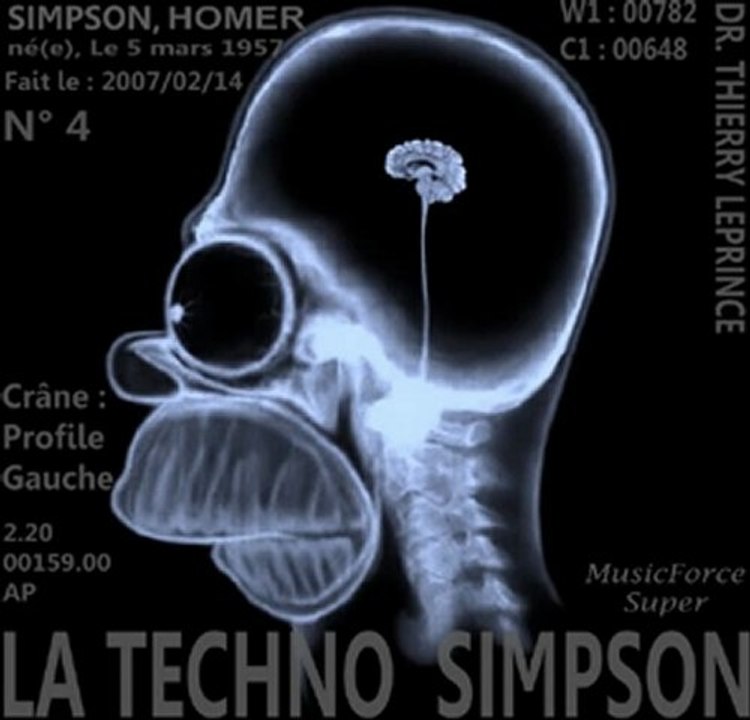 LA TECHNO SIMPSON-THIERRY LEPRINCE de l' amour est aveugle 2-TF1-HIGHT QUALITY
