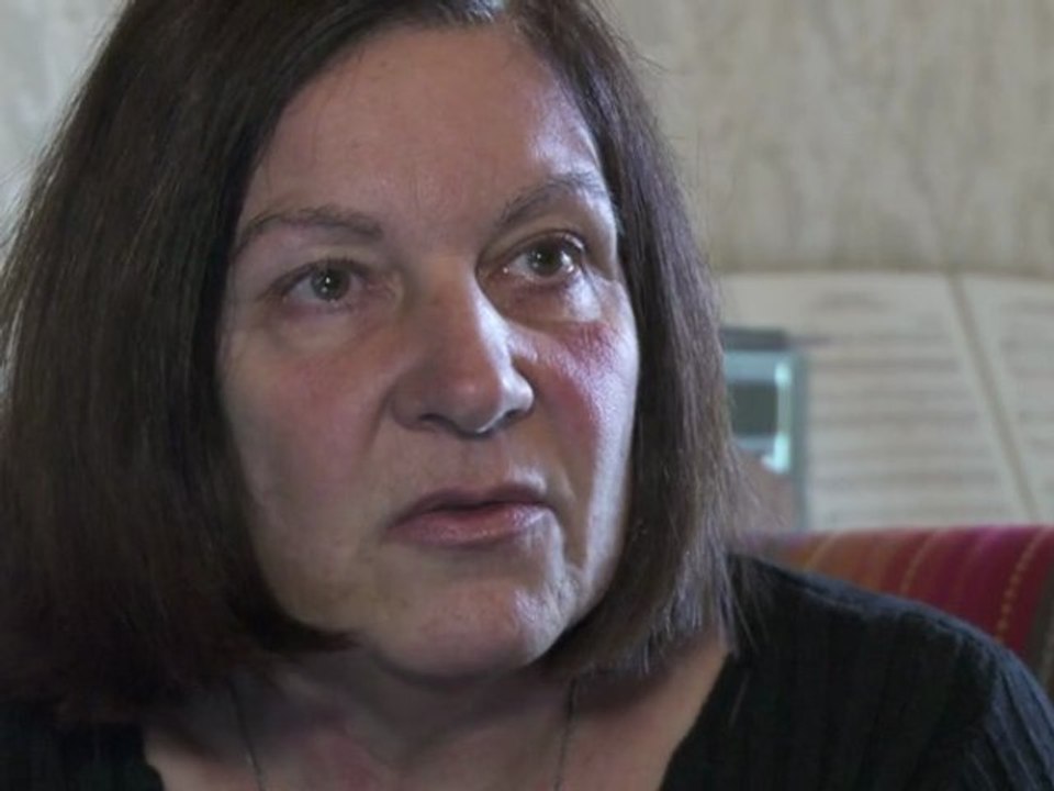 Prothèses mammaires PIP: une victime témoigne