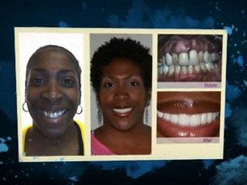 Dentist Philadelphia