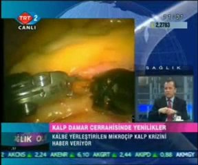 Sağlık Olsun - Kalp Cerrahisinde Yenilikler 19.03.2009