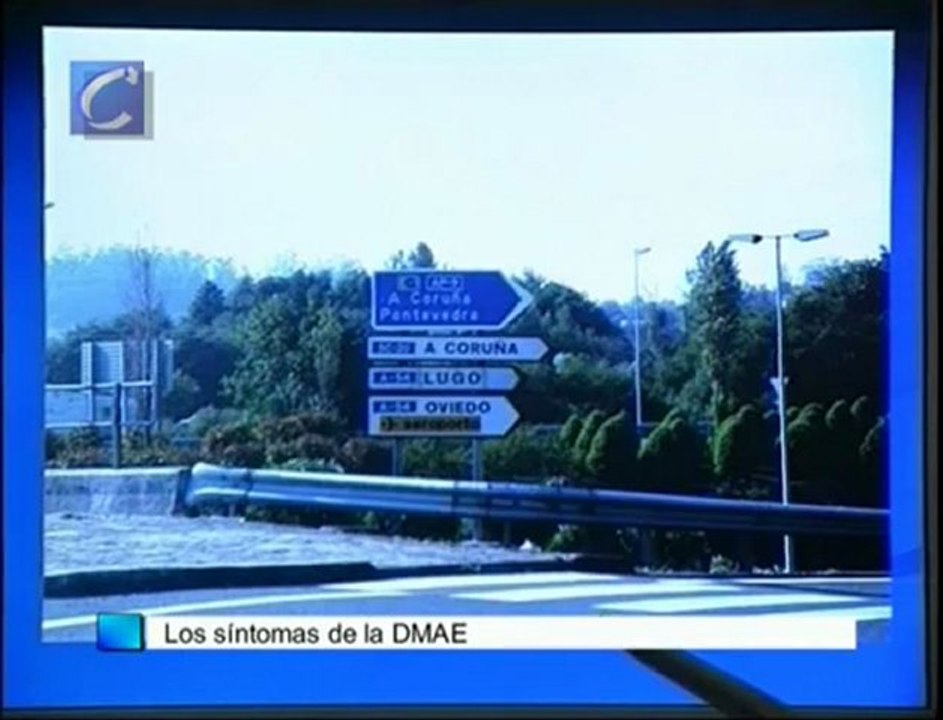 Reducir en un 20% los casos de ceguera legal en Castilla y León, objetivos de una campaña de Ceoma