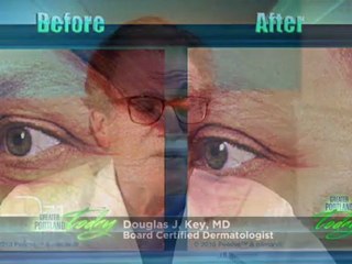 BOTOX® for Portland Eye Treatment