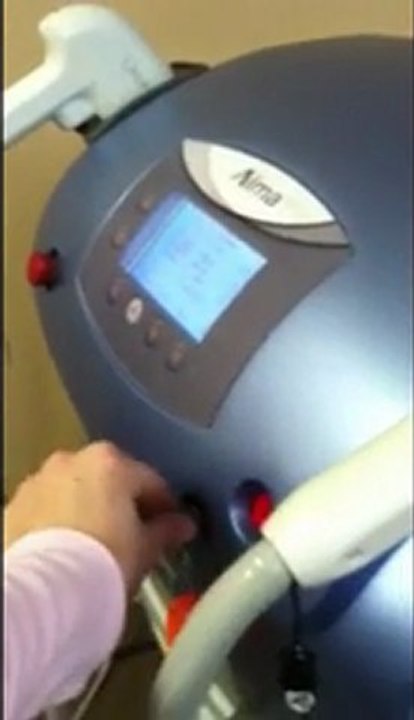 2006 Alma Accent XL Radio Frequency Laser