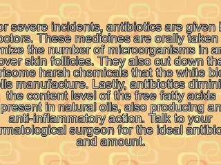 5 Healthy and Non-Natural Pimple Treatments