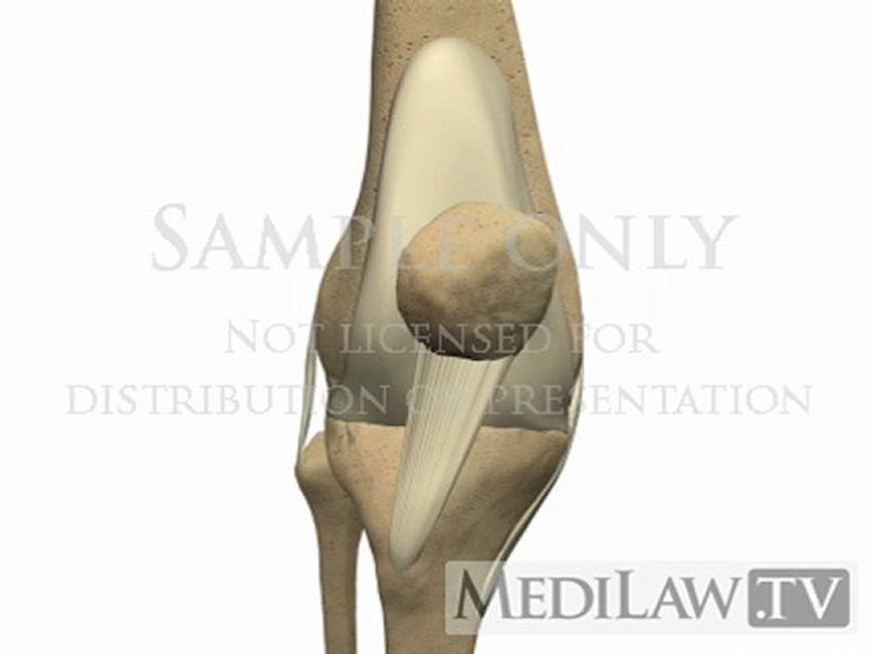 Knee Joint Anatomy medical trial graphics