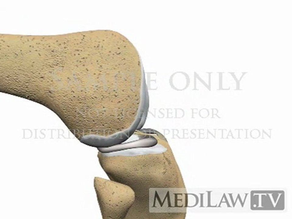 Knee Meniscus Meniscal Anatomy models 3D knee