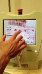 2008 Osyris Lipotherme 980 nm Diode Lipolysis Laser