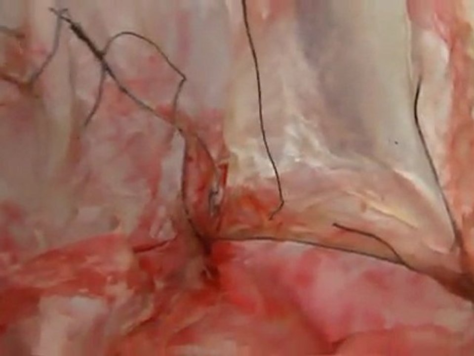 cardiomanie 2