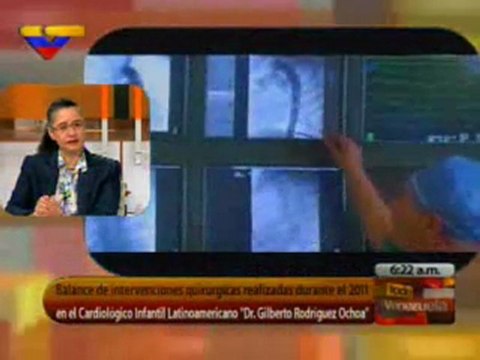 (VIDEO) Toda Venezuela Entrevista a la directora del Cardiolgico Infantil 03.01.2012 1/2