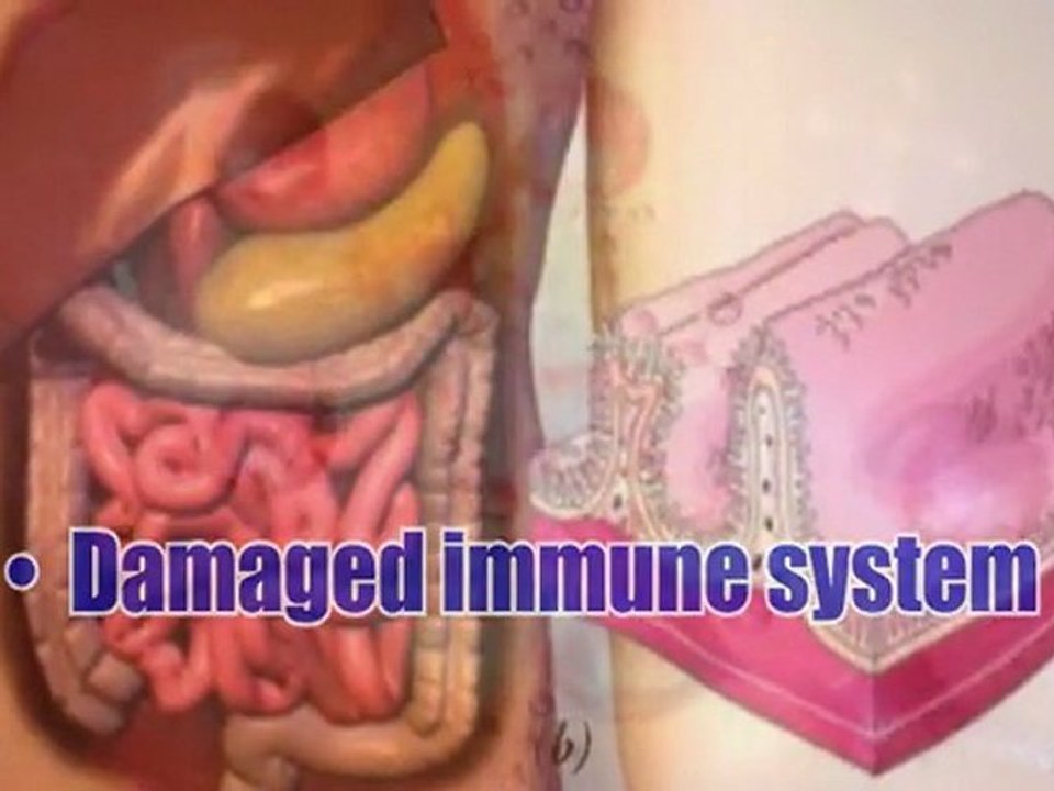 How Lack of Sleep Affects Your Body?