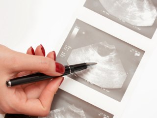 How to recognize possible symptoms of ovarian cancer