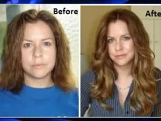 Mira Hair Oil Reviews - Before _ After Photos, Must See!