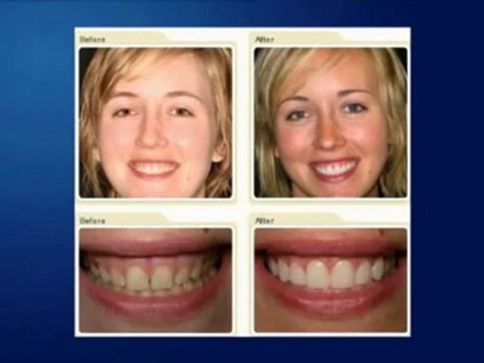 Boulder Cosmetic Dentist