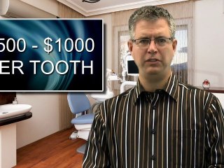 Veneers - What Does it Cost?