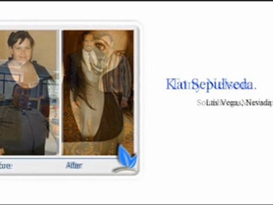 San Antonio TX Weight Loss Surgery