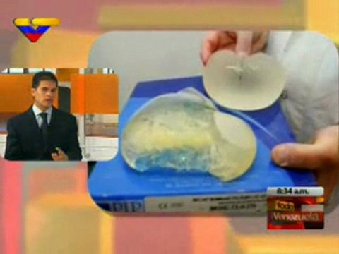 (Video) Reemplazo de prótesis mamarias se puede realizar en la misma sesión de retiro de implantes PIP