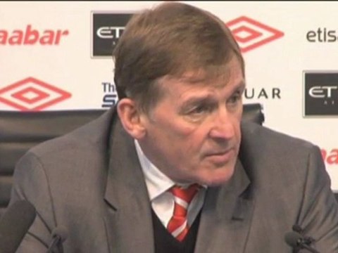 Carling - Dalglish contento con sus jugadores