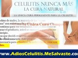 Tratamientos Para La Celulitis y Eliminacion Celulitis - Eliminar Celulitis Para Siempre