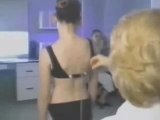 Scoliosis Brace