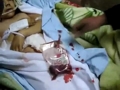 فري برس حمص دير بعلبة الشهيد الطفل ايوب محمد الفندي 5 12 2011