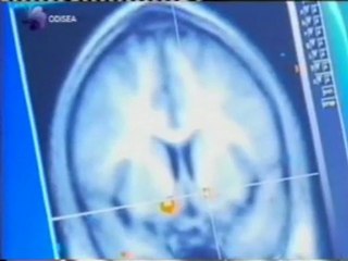 Neuroeconomia: Nucleo accumbens (Dinero, ambicion y crisis economica)