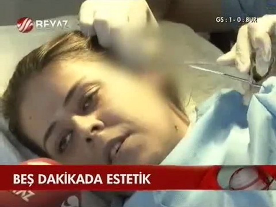 Op. Dr. Güner UYSAL Ameliyatsız Burun Estetiği