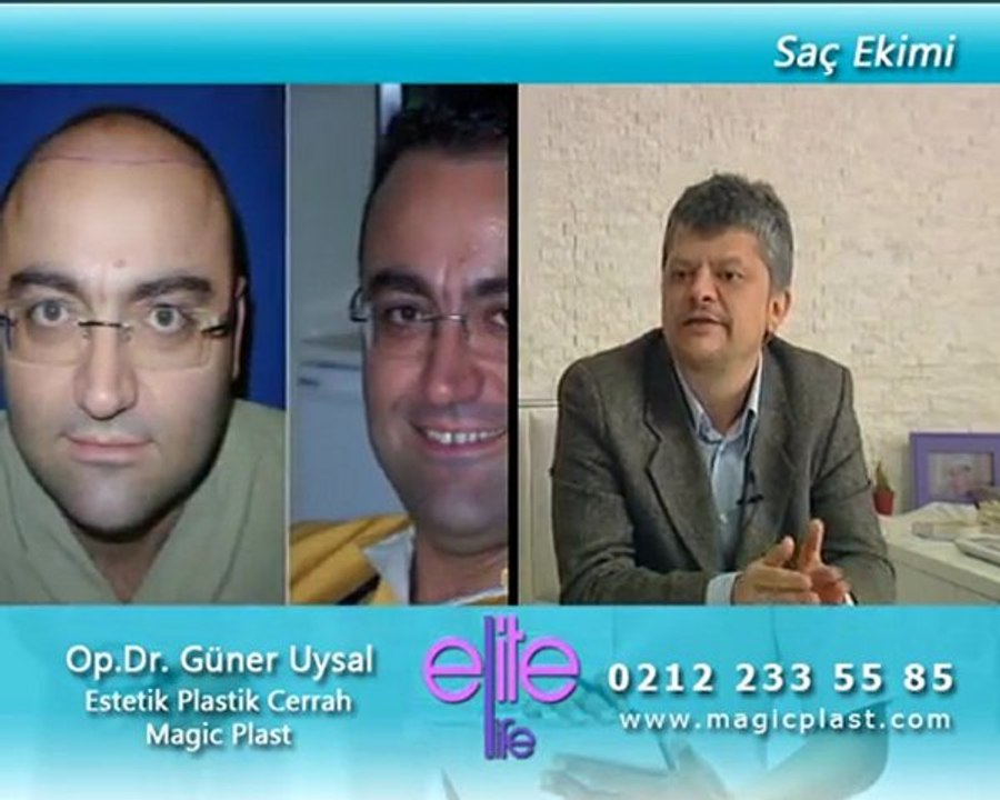 Star Tv'de Op. Dr. Güner Uysal Saç Ekimi ile İlgili Bilgi Veriyor