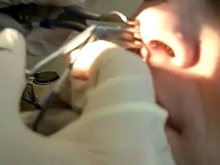 Crotte de nez d'Alien