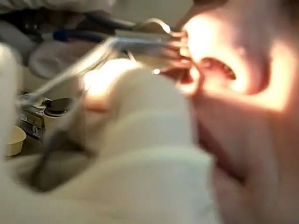 Vidéo Insolite : une crotte de nez géante sort de son nez