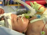 Un bébé de 5 mois sous coeur artificiel dans l'attente d'un don d'organe