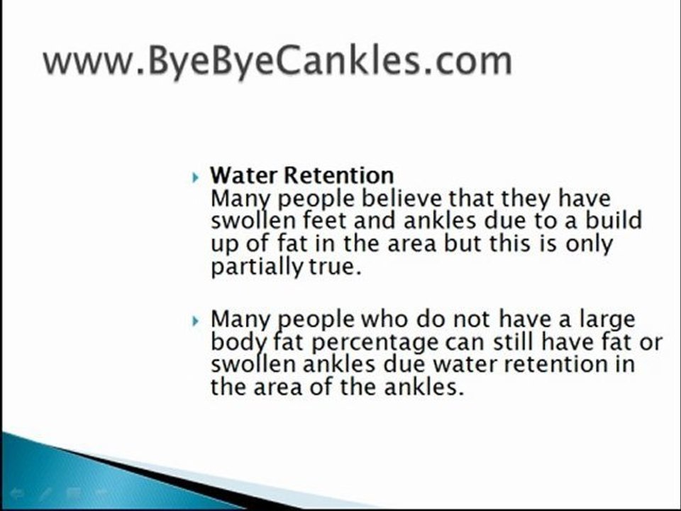 Edema Feet and Ankles - Removing Your Cankles