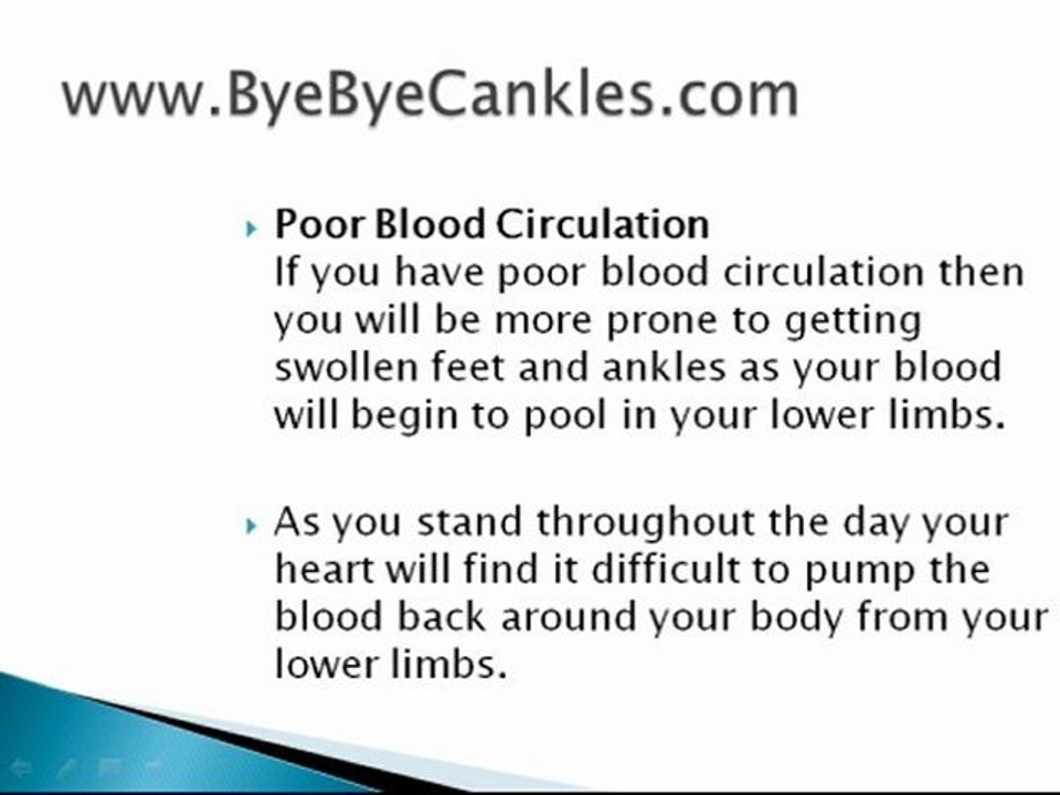 Puffy Feet and Ankles - Get Rid of Cankles