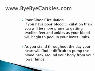 Puffy Feet and Ankles - Get Rid of Cankles