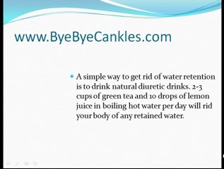 Treatment of Swollen Ankles