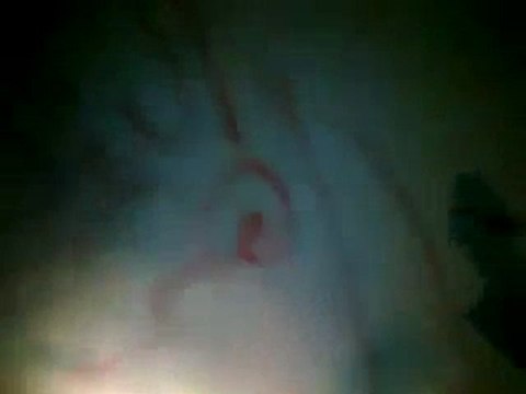 فري برس خربة غزالة حملة الرجل البخاخ اليومية ج1