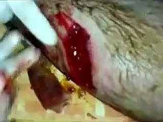 فري برس   جب الجندلي طلق ناري في الساق 10  11  2011