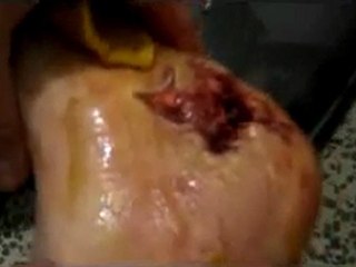 فري برس   حمص البياضة عدة جرحى برصاص الغدر27 11 2011