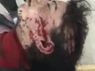 فري برس   القصير شهيدة برصاص ميليشيات الاسد في قرية النزارية 19 10 2011