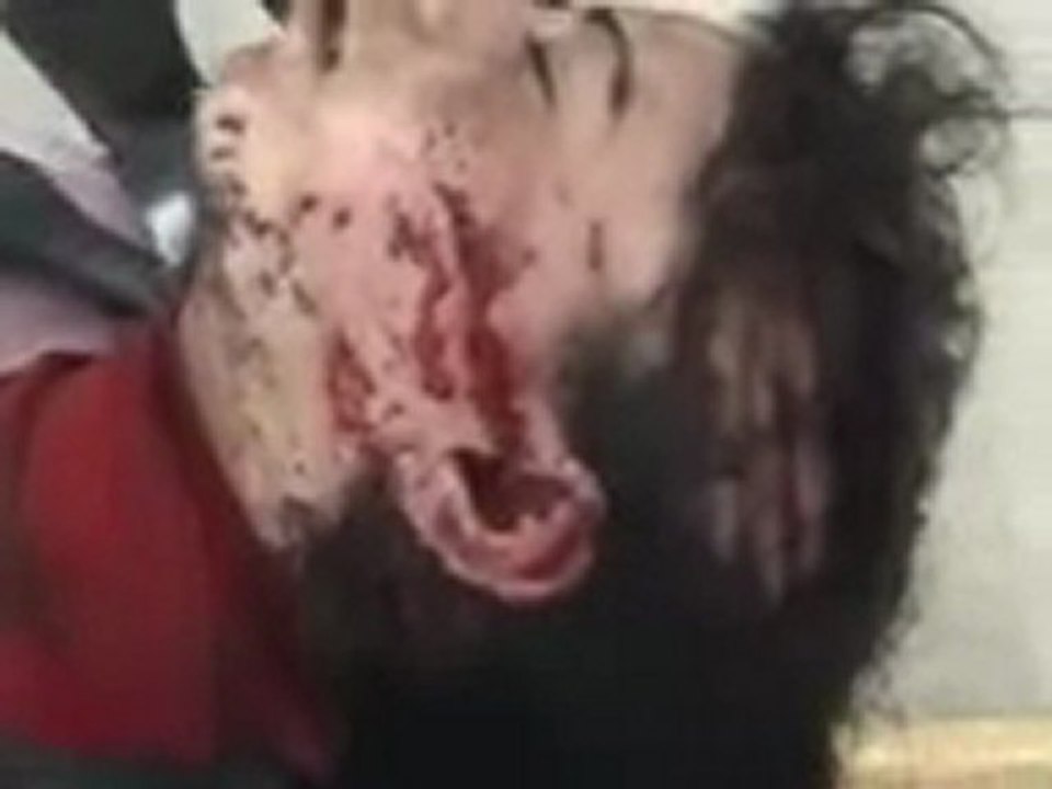 فري برس   القصير شهيدة برصاص ميليشيات الاسد في قرية النزارية 19 10 2011