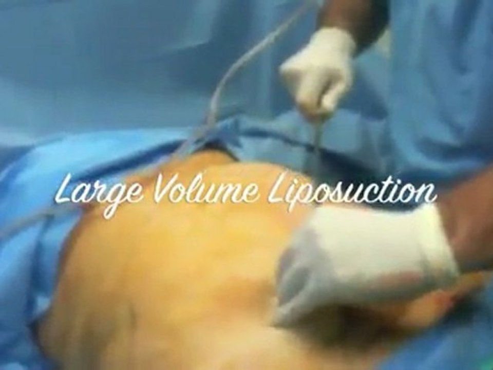 {Hawaii liposuction great for the military