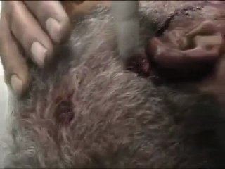 فري برس   حمص باباعمرو  جريح برصاص قناصة 27 12 2011