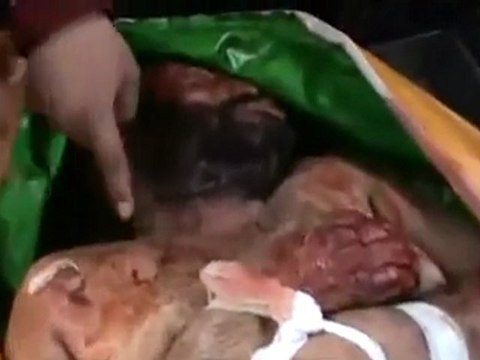 فري برس حمص باباعمرو الشهيد فواز النهار تحت التعذيب 2 1 2012