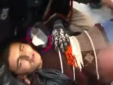 فري برس   ادلب جسرالشغور احد المصابين الذين اطلق عليهم النار عند محاولتهم الدخول الى المدينة لمقابلة لجنة المراقبين10 1 2012 ج2