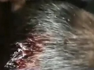 فري برس   حمص وادي العرب أحد الإصابات التي تحدث يوميا
